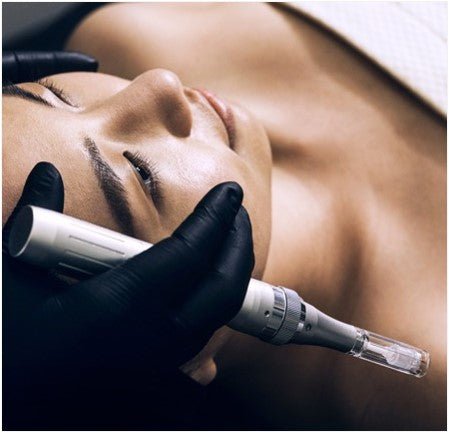 Microneedling Post-Procedure - Rajan Dermatology