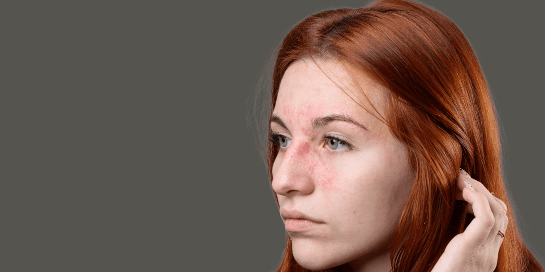 Sensitive Skin - Rajan Dermatology