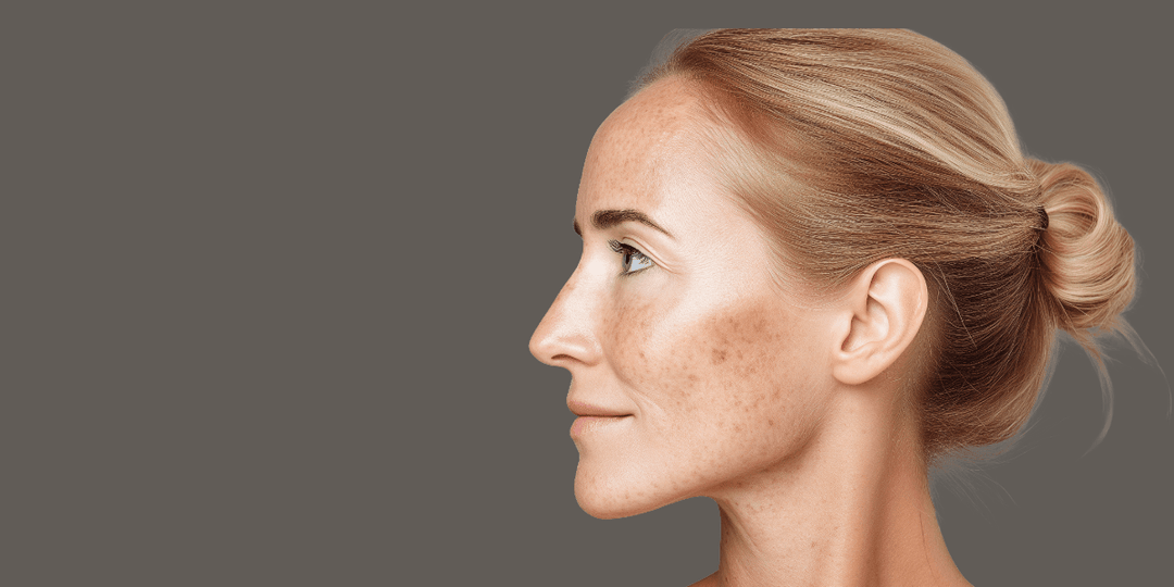 Uneven Skin Tone - Rajan Dermatology