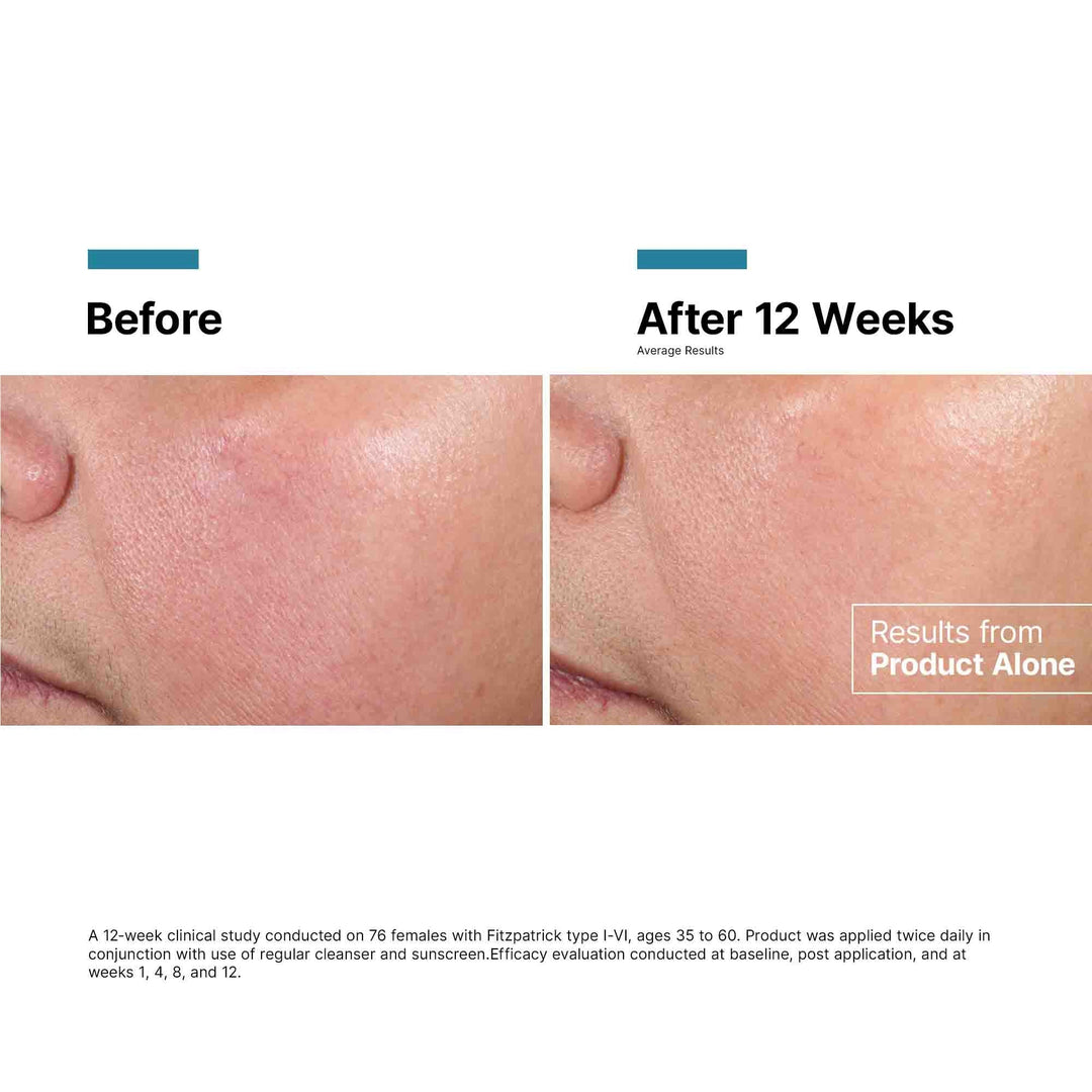 SkinCeuticals - SkinCeuticals Advanced RGN-6