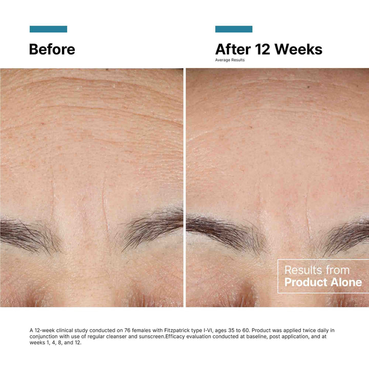 SkinCeuticals - SkinCeuticals Advanced RGN-6