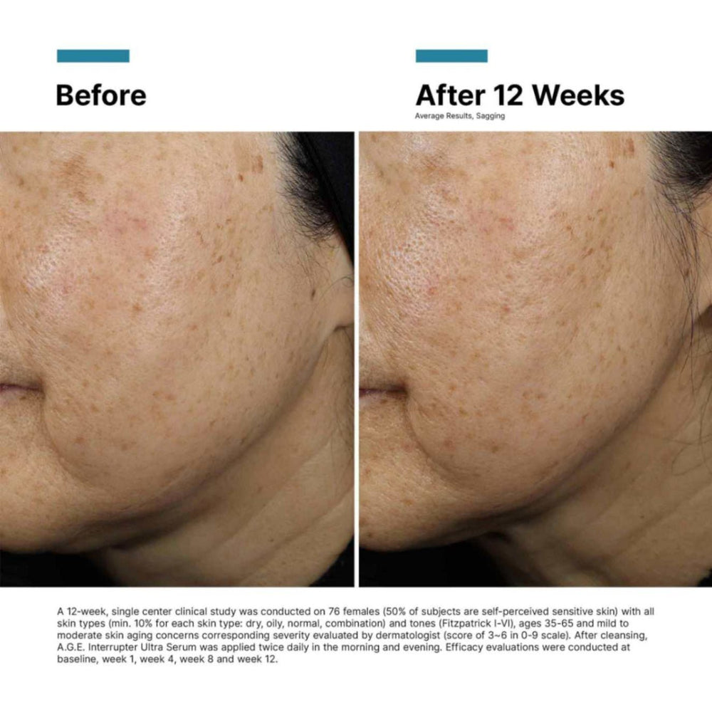 SkinCeuticals - A.G.E. Interrupter Ultra Serum - 