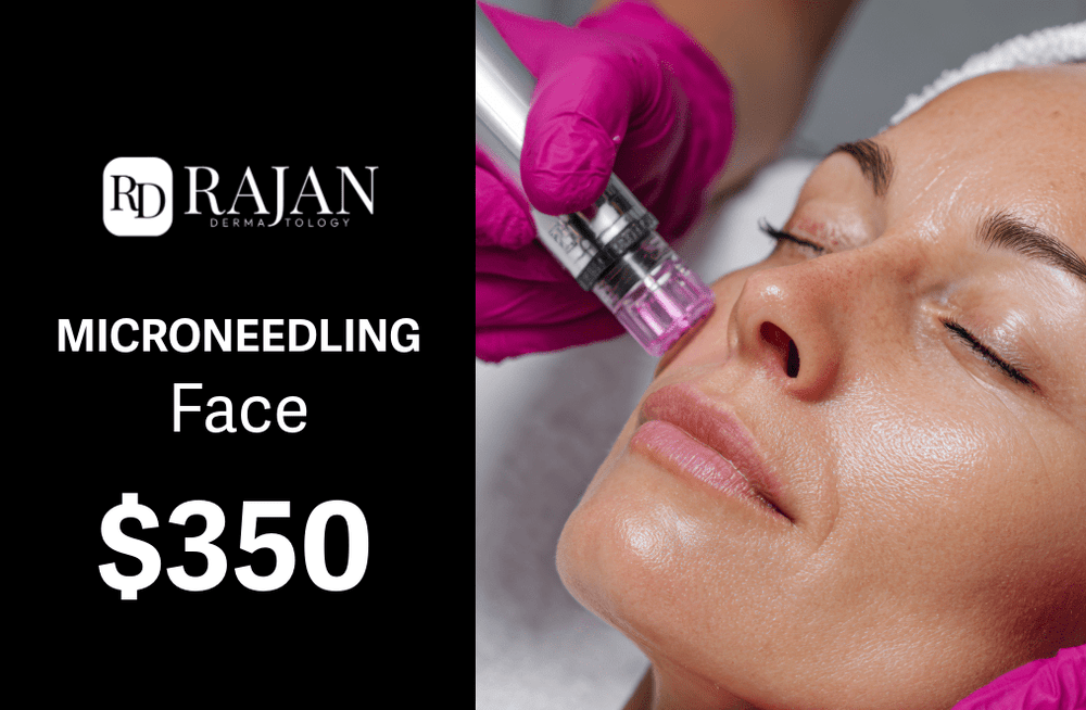 Rajan Dermatology - Microneedling Face -