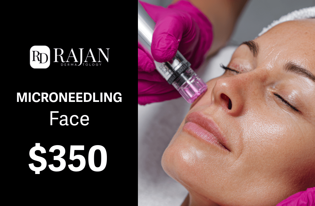 Rajan Dermatology - Microneedling Face -