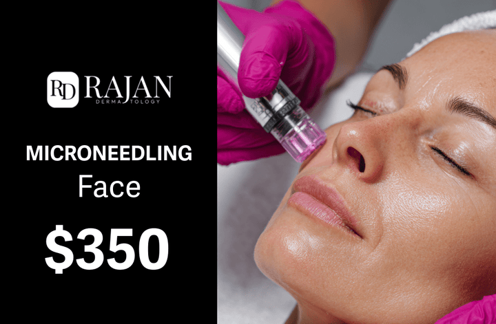 Rajan Dermatology - Microneedling Face -