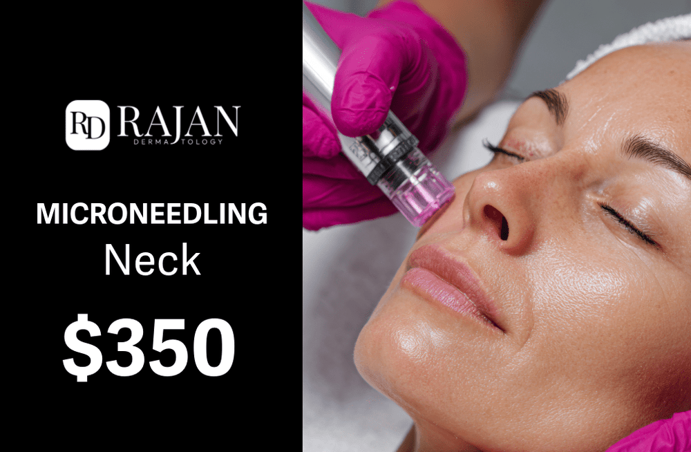 Rajan Dermatology - Microneedling Neck -