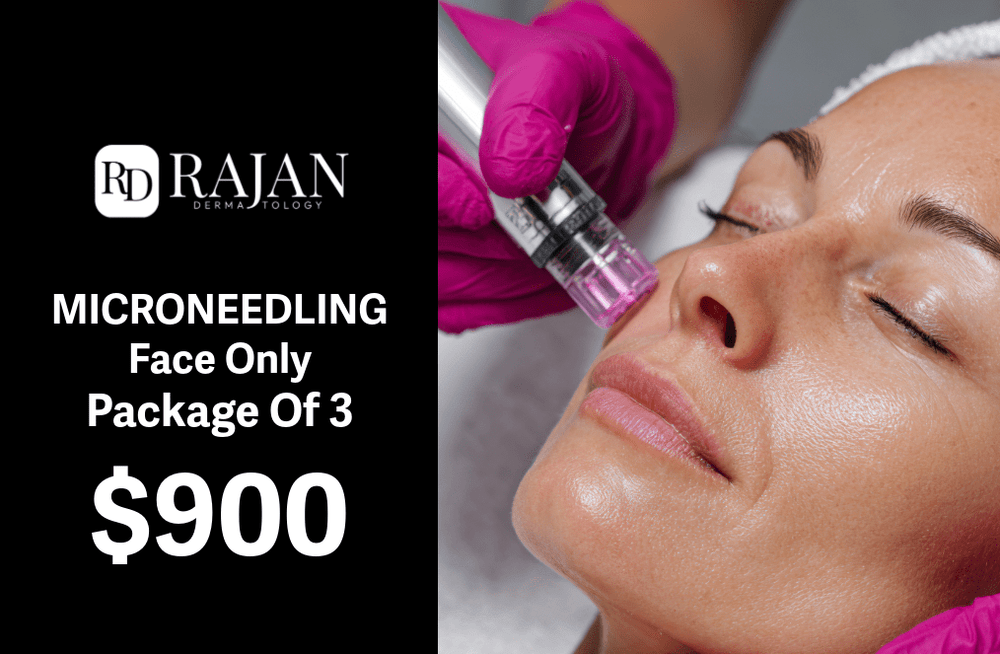 Rajan Dermatology - Microneedling Package Of 3 + Free Neck -