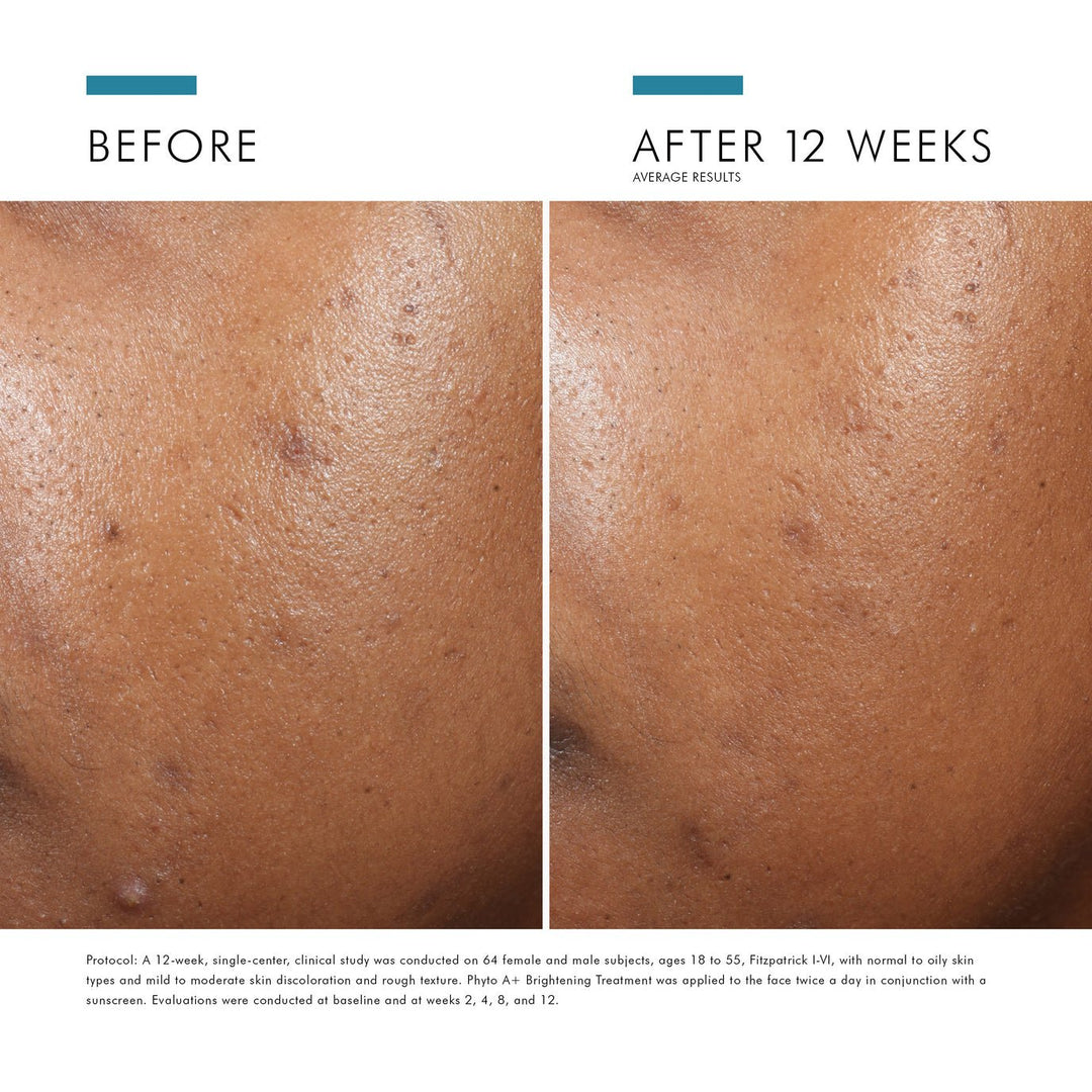 SkinCeuticals - Phyto A+ Brightening Treatment - 